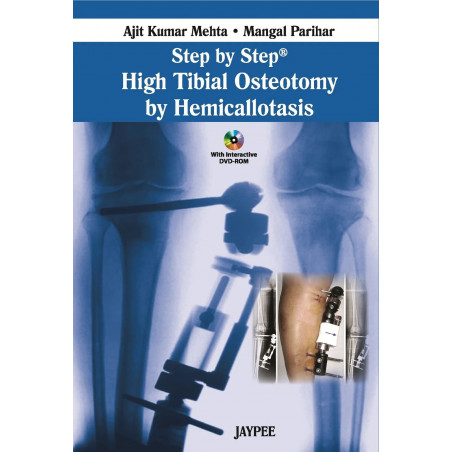 STEP BY STEP HIGH TIBIAL OSTEOTOMY BY HEMICALLOTASIS WITH DVD ROM book by Mehta