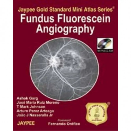Fundus Fluorescein Angiography Jaypee Gold Standard Mini Atlas Series With Photo Cd-Rom book by Garg
