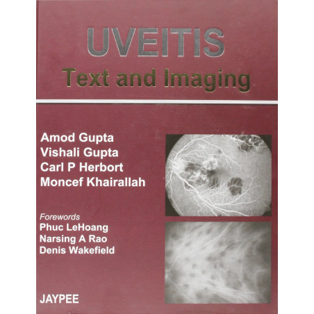 Uveitis Text And Imaging book by Gupta, Amod Gupta