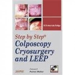 Step by Step Colposcopy, Cryo-Surgery and Leep with DVD-ROM book by Baliga, Shakuntala