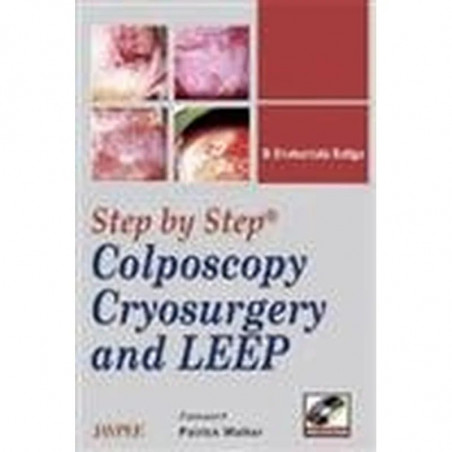 Step by Step Colposcopy, Cryo-Surgery and Leep with DVD-ROM book by Baliga, Shakuntala