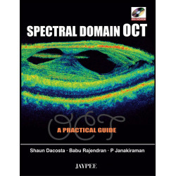 Spectral Domain Oct With Dvd-Rom A Practical Guide book by Shaun Dacosta