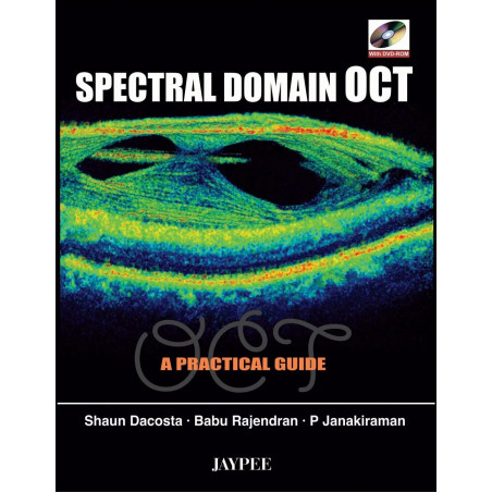 Spectral Domain Oct With Dvd-Rom A Practical Guide book by Shaun Dacosta