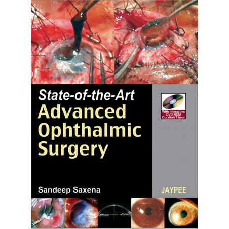 State-of-the-Art Advanced Ophthalmic Surgery (with DVD-ROM) (POD) book by Saxena