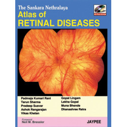 The Sankara Nethralaya Atlas of Retinal Diseases with Photo DVD-ROM book by Padmaja