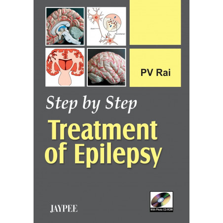 STEP BY STEP TREATMENT OF EPILEPSY WITH PHOTO CD-ROM book by Rai