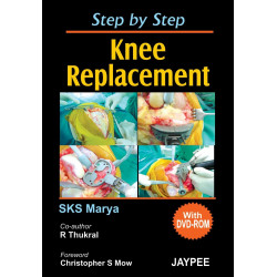 Step by Step Knee Replacement (with DVD Rom) book by S.K.S. Marya