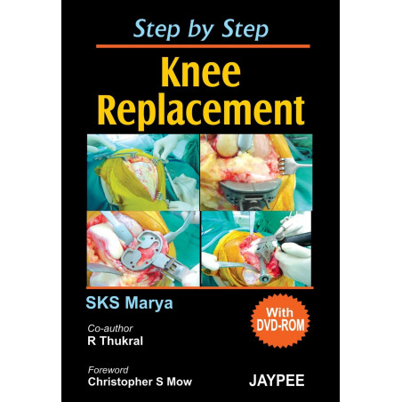 Step by Step Knee Replacement (with DVD Rom) book by S.K.S. Marya