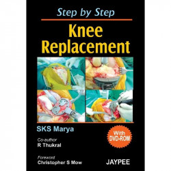 Step by Step Knee Replacement (with DVD Rom) book by S.K.S. Marya - Back Cover