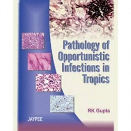 Pathology of Opportunistic Infections in Tropics book by R.K. Gupta