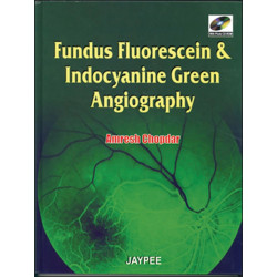 Fundus Fluorescein and Indocyanine Green Angiography (with Photo CD-ROM) (POD) book by Amresh Chopdar