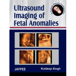 Ultrasound Imaging of Fetal Anomalies (Dr Kuldeep’s Obstetric Sonology Series) (POD) book by Singh