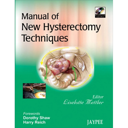 MANUAL OF NEW HYSTERECTOMY TECHNIQUES WITH INCT.DVD-ROM book by METTLER