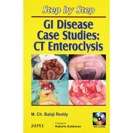 Step By Step Gi Disease Case Studies Ct Enteroclysis With Cd Rom book by Reddy