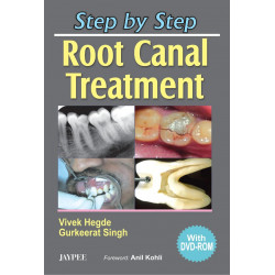 Step by Step Root Canal Treatment (with DVD ROM) book by Hegde