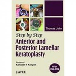 STEP BY STEP ANTERIOR AND POSTERIOR LAMELLAR KERATOPLASTY(WITH DVD) book by John