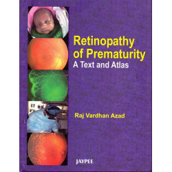 Retinopathy of Prematurity a Text and Atlas book by Azad