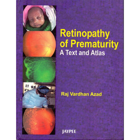 Retinopathy of Prematurity a Text and Atlas book by Azad
