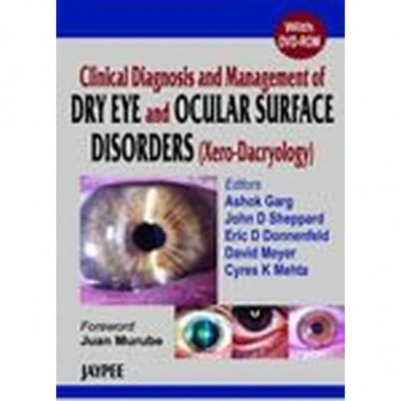 Clincl Diagnosis Management of Dry Eye book by Garg