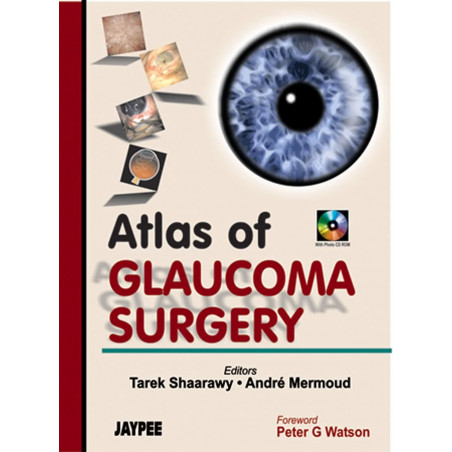 Atlas of Glaucoma Surgery with Photo CD-ROM book by Shaarway