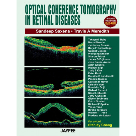Optical Coherence Tomography in Retinal Diseases: with Photo DVD-ROM (Complete Book Available in PDF Format) (POD) book by S…