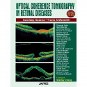 Optical Coherence Tomography in Retinal Diseases: with Photo DVD-ROM (Complete Book Available in PDF Format) (POD) book by S… -