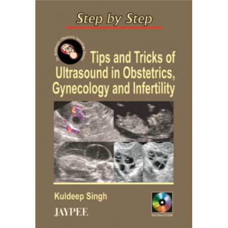 Step by Step Tips and Tricks of Ultrasound in Obstetrics, Gynaecology and Infertility book by Kuldeep Singh