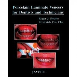 PORCELAIN LAMINATE VENEERS FOR DENTISTS AND TECHNICIANS book by Smales