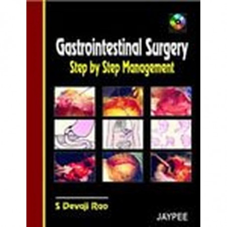 Gastrointestinal Surgery Step by Step Management with CD-ROM book by S. Devoji Rao