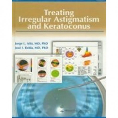 Treating Irregular Astigmatism and Keratoconus book