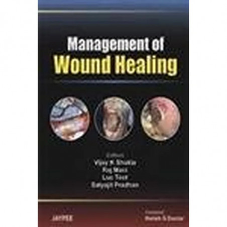 MANAGEMENT OF WOUND HEALING book by Shukla