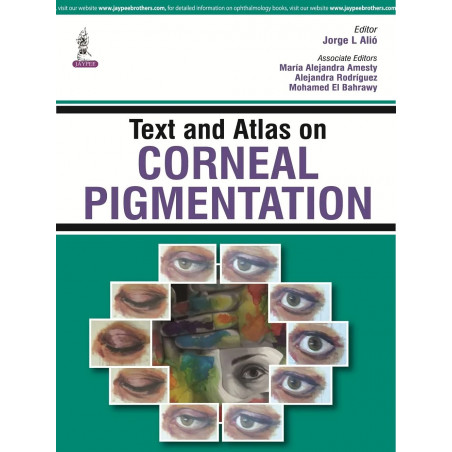 (OLD EDITION) text and atlas on corneal pigmentation book by Alio Jorge L