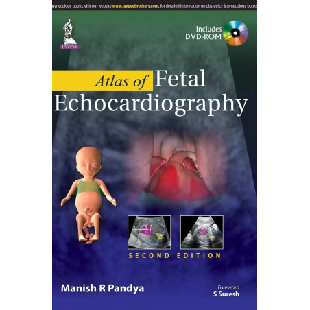 Atlas of Fetal Echocardiography with Interactive DVD-ROM book by Pandya Manish R