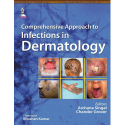 COMPREHENSIVE APPROACH TO INFECTIONS IN DERMATOLOGY book by Singal Archana, Archana Singal