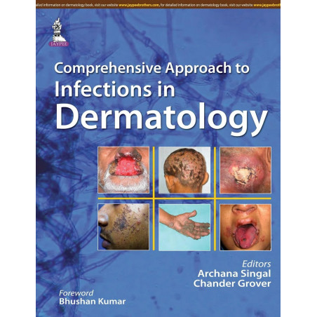 COMPREHENSIVE APPROACH TO INFECTIONS IN DERMATOLOGY book by Singal Archana, Archana Singal