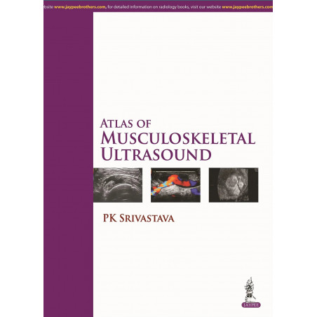 Atlas of Musculoskeletal Ultrasound book by Srivastava Pk