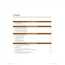 COMPREHENSIVE APPROACH TO INFECTIONS IN DERMATOLOGY book by Singal Archana, Archana Singal - Additional Image 6