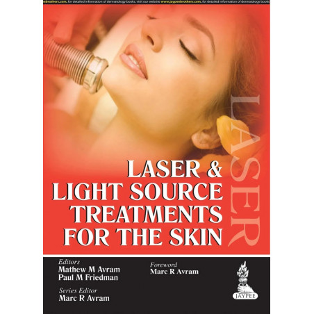LASER & LIGHT SOURCE TREATMENTS FOR THE SKIN book by Avram Mathew M