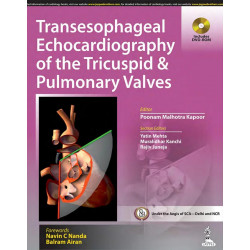 TRANSESOPHAGEAL ECHOCARDIOGRAPHY OF THE TRICUSPID & PULMONARY VALVES INCLUDES DVD-ROM book by Kapoor Poonam Malhotra