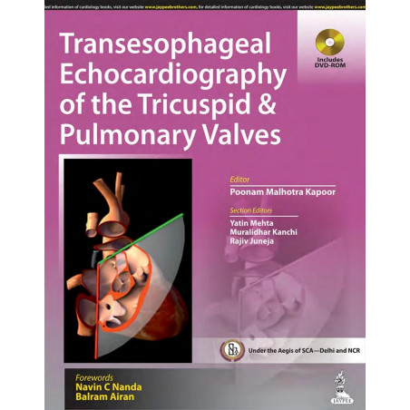 TRANSESOPHAGEAL ECHOCARDIOGRAPHY OF THE TRICUSPID & PULMONARY VALVES INCLUDES DVD-ROM book by Kapoor Poonam Malhotra