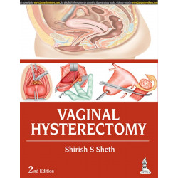 VAGINAL HYSTERECTOMY book by Sheth Shirish S