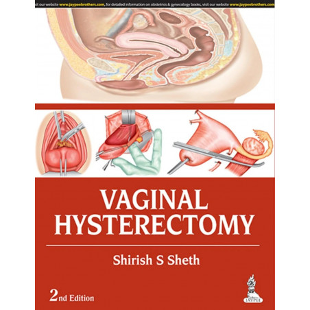 VAGINAL HYSTERECTOMY book by Sheth Shirish S