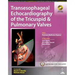 TRANSESOPHAGEAL ECHOCARDIOGRAPHY OF THE TRICUSPID & PULMONARY VALVES INCLUDES DVD-ROM book by Kapoor Poonam Malhotra - Back Cove
