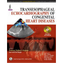 TRANSESOPHAGEAL ECHOCARDIOGRAPHY OF CONGENITAL HEART DISEASES book by Kapoor Poonam Malhotra