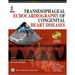 TRANSESOPHAGEAL ECHOCARDIOGRAPHY OF CONGENITAL HEART DISEASES book by Kapoor Poonam Malhotra