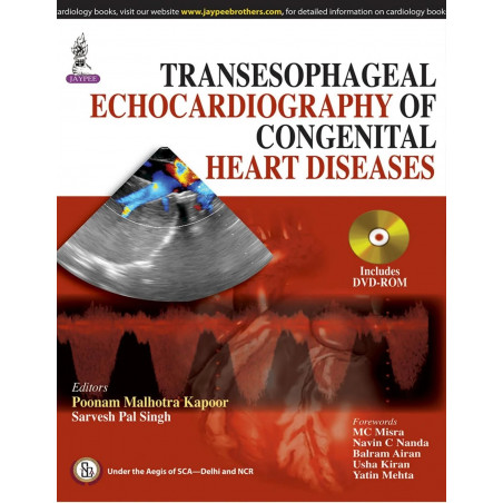 TRANSESOPHAGEAL ECHOCARDIOGRAPHY OF CONGENITAL HEART DISEASES book by Kapoor Poonam Malhotra