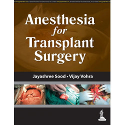 ANESTHESIA FOR TRANSPLANT SURGERY book by Jayashree Sood