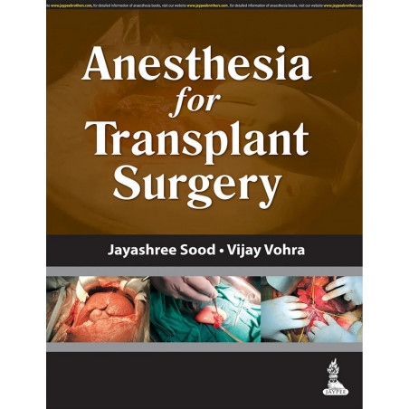 ANESTHESIA FOR TRANSPLANT SURGERY book by Jayashree Sood