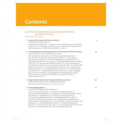 TRANSESOPHAGEAL ECHOCARDIOGRAPHY OF THE TRICUSPID & PULMONARY VALVES INCLUDES DVD-ROM book by Kapoor Poonam Malhotra - Additiona