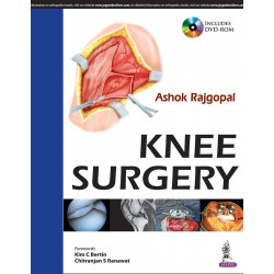 KNEE SURGERY INCLUDES DVD-ROM book by Rajgopal Ashok